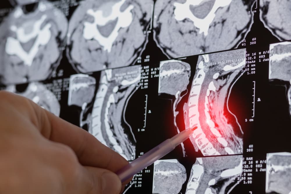 close-doctor-learning-mri-xray-curvature