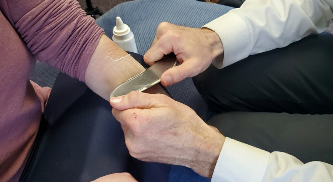 InstrumentAssisted Soft Tissue Mobilization (IASTM) Northern Nevada