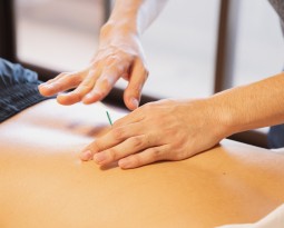 Top 5 Conditions Helped by Functional Dry Needling